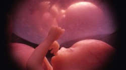 Twins in the Womb {3014}